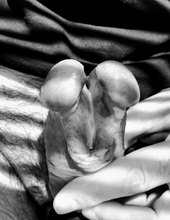 Split glans B&W