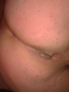 new