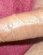 mmm