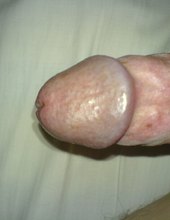 mix