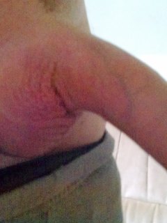 gargy