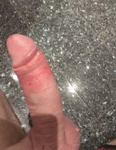 Na hotelu