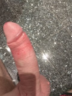 Na hotelu