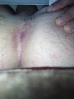 Anal