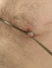 Sub bradavka