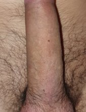POV