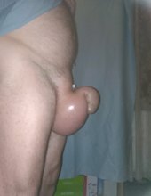 saline 3 litry