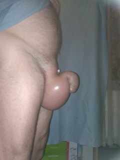 saline 3 litry