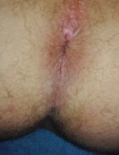 Dirka