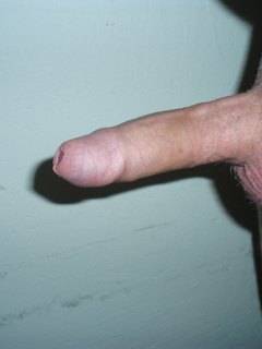 penis