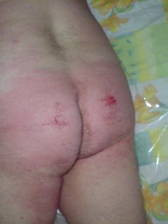 spank